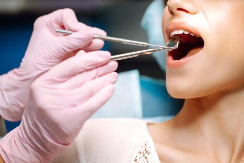 Composite Veneers Adelaide 