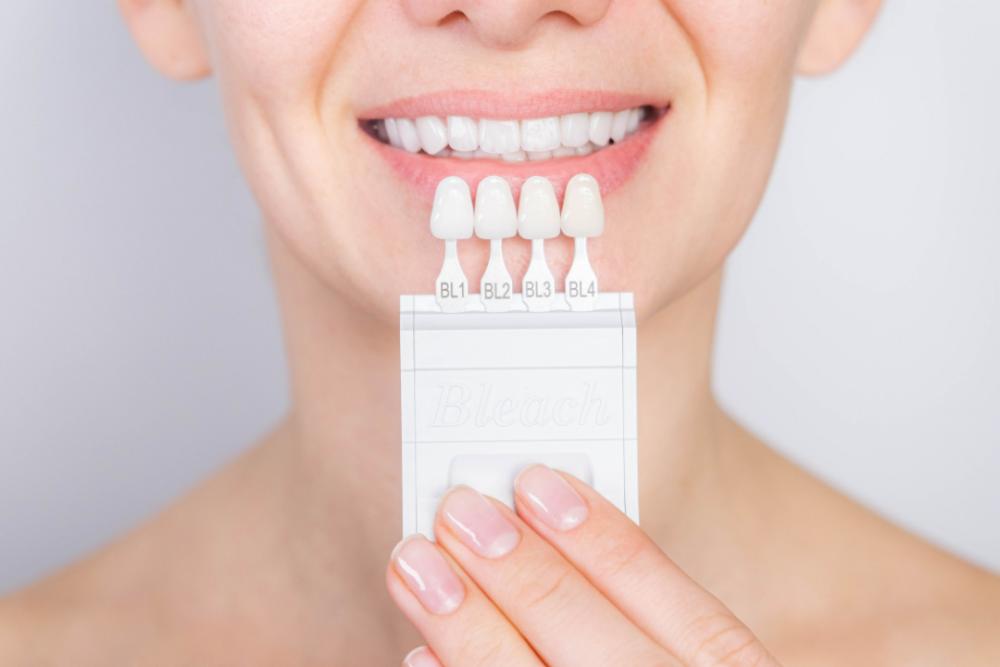 Veneers Adelaide veneers-adelaide